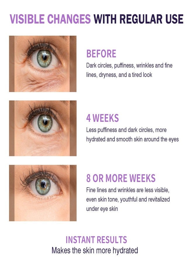 IREV Eye Serum with 5% Mate Caffeine, Under Eye Cream for Puffy Bags Fine Lines Dark Circles Wrinkles, 360° Roller Massage Ball Eyes Treatment Serum Brightens Tired Eyes 5ml 0.5 fl. oz - Image 4